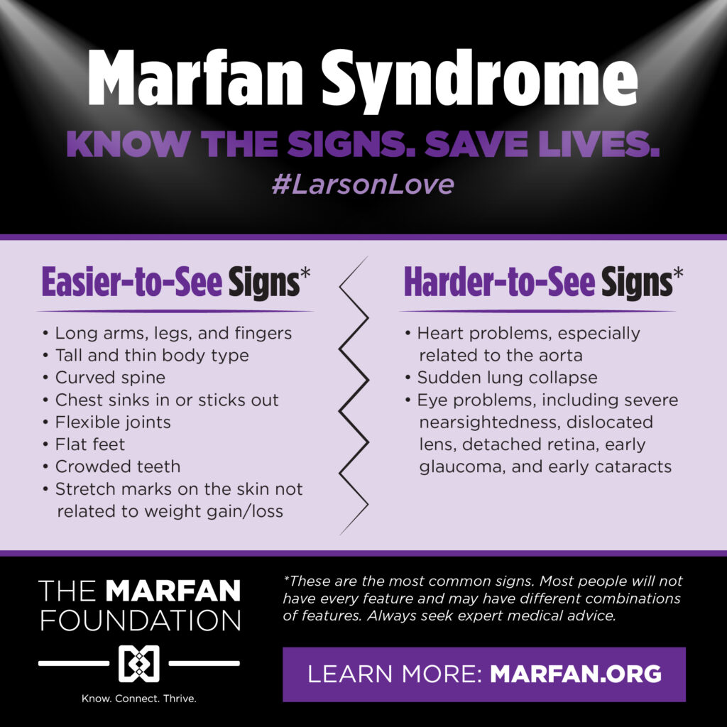 Marfan Syndrome. Know the Signs. Save Lives. #LarsonLoveEasier to see signs:Long arma, legs, and fingerstall and thin body typeCurved spineChest sinks in or sticks outFlexible joinsFlat feetCrowded teethStretch marks on the skin not related to weigh gain or lossHarder to see signsHeart problems, especially related to the aortsSudden lung collapesEye problemsNote: these are the most common signs. Most people will not have every feature and may have different combinations of features. Always seek expert medical advice.